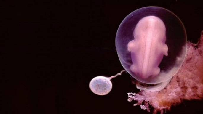 human embryo pictures