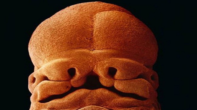 human embryo pictures