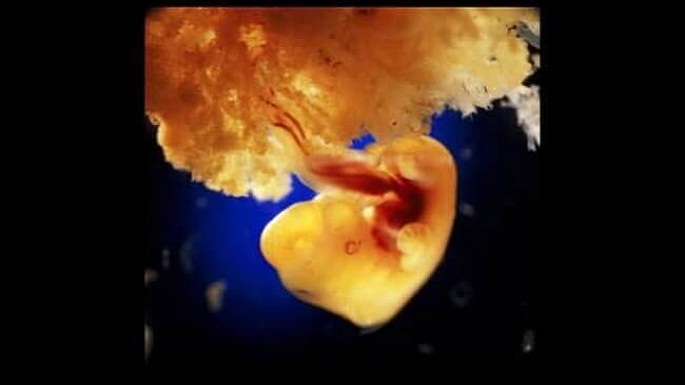 human embryo pictures