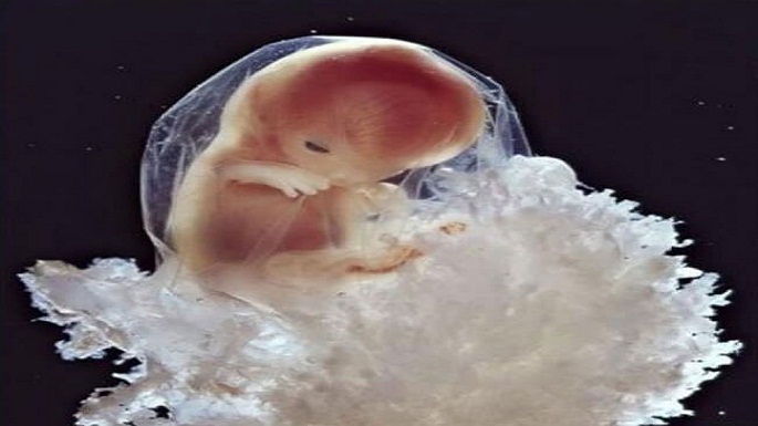 human embryo pictures