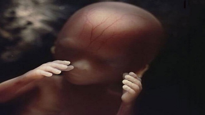 human embryo pictures