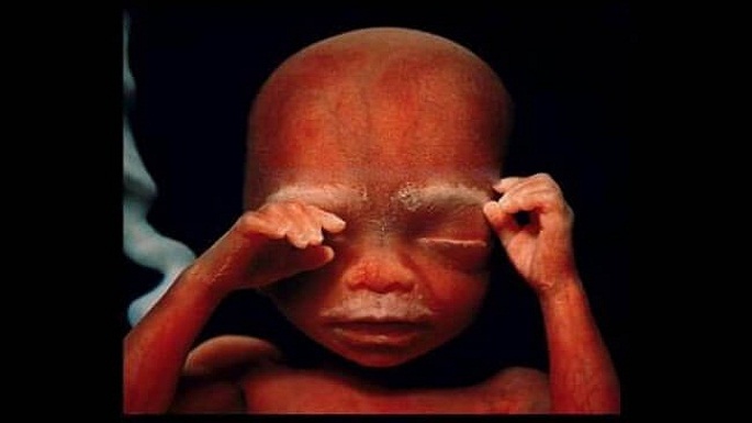 human embryo pictures