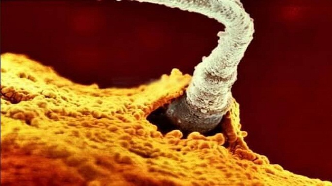 human embryo pictures