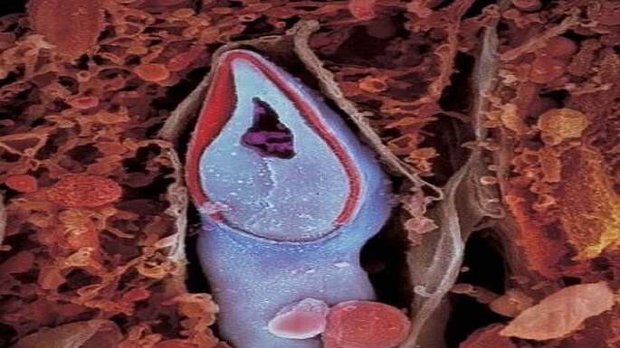 human embryo pictures