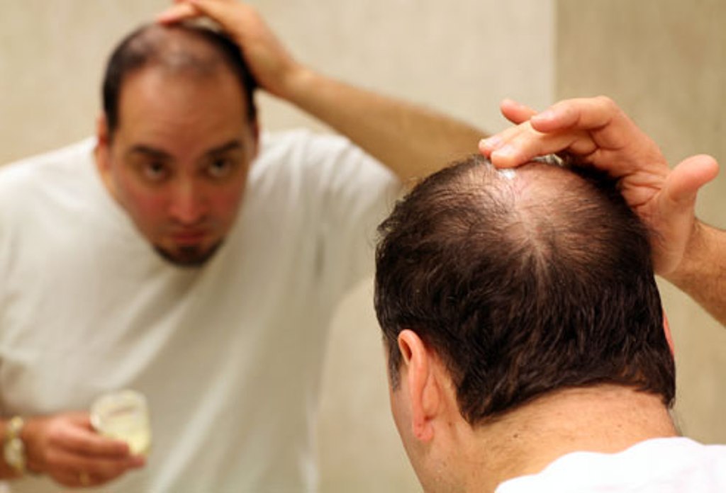 Know the Reason behind your Hairfall Know the Reason behind your Hairfall