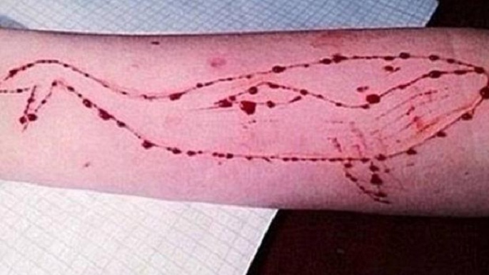 blue whale