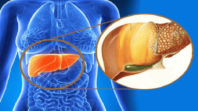 fatty liver problem