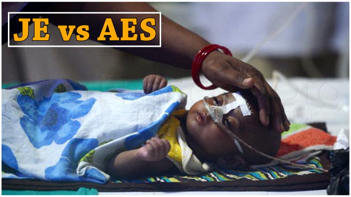 Acute Encephalitis Syndrome