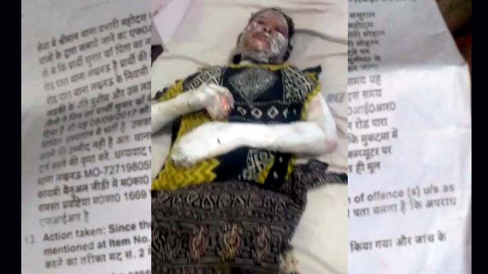 woman Burnt alive