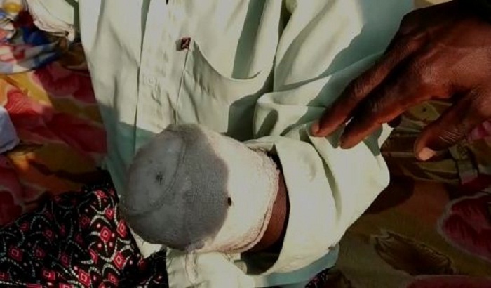 cut his niece husbands hand for lending the money